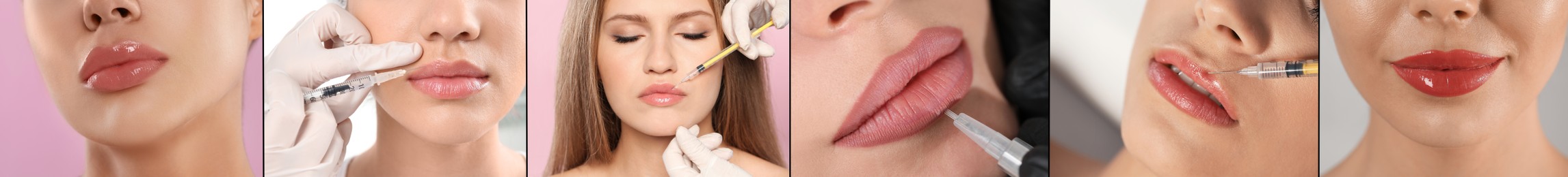 Collage with photos of women during procedures of lip augmentation and permanent makeup, closeup. Banner design
