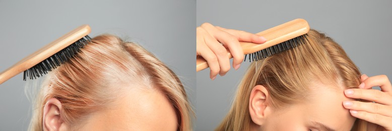 Image of Woman before and after hair treatment with high frequency darsonval device on grey background, closeup. Collage of photos
