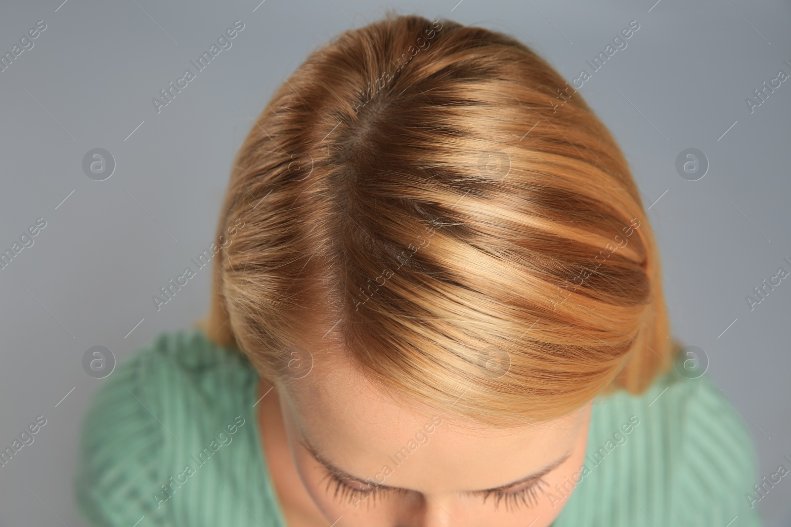 Photo of Woman with hair loss problem on grey background, above view. Trichology treatment