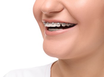 Photo of Smiling woman with dental braces on white background, closeup