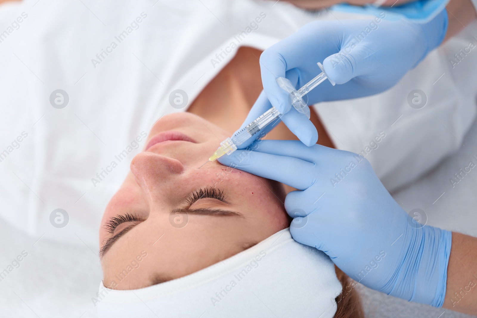 Photo of Woman undergoing face biorevitalization procedure in salon, closeup. Cosmetic treatment