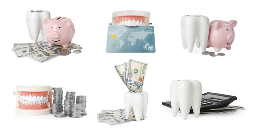 Image of Set with educational dental models and money on white background, banner design. Expensive teeth treatment