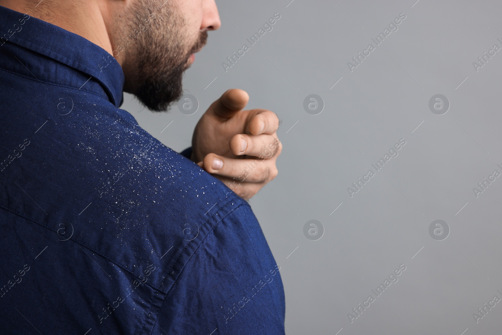 Photo of Man brushing dandruff off his shirt on grey background, closeup. Space for text