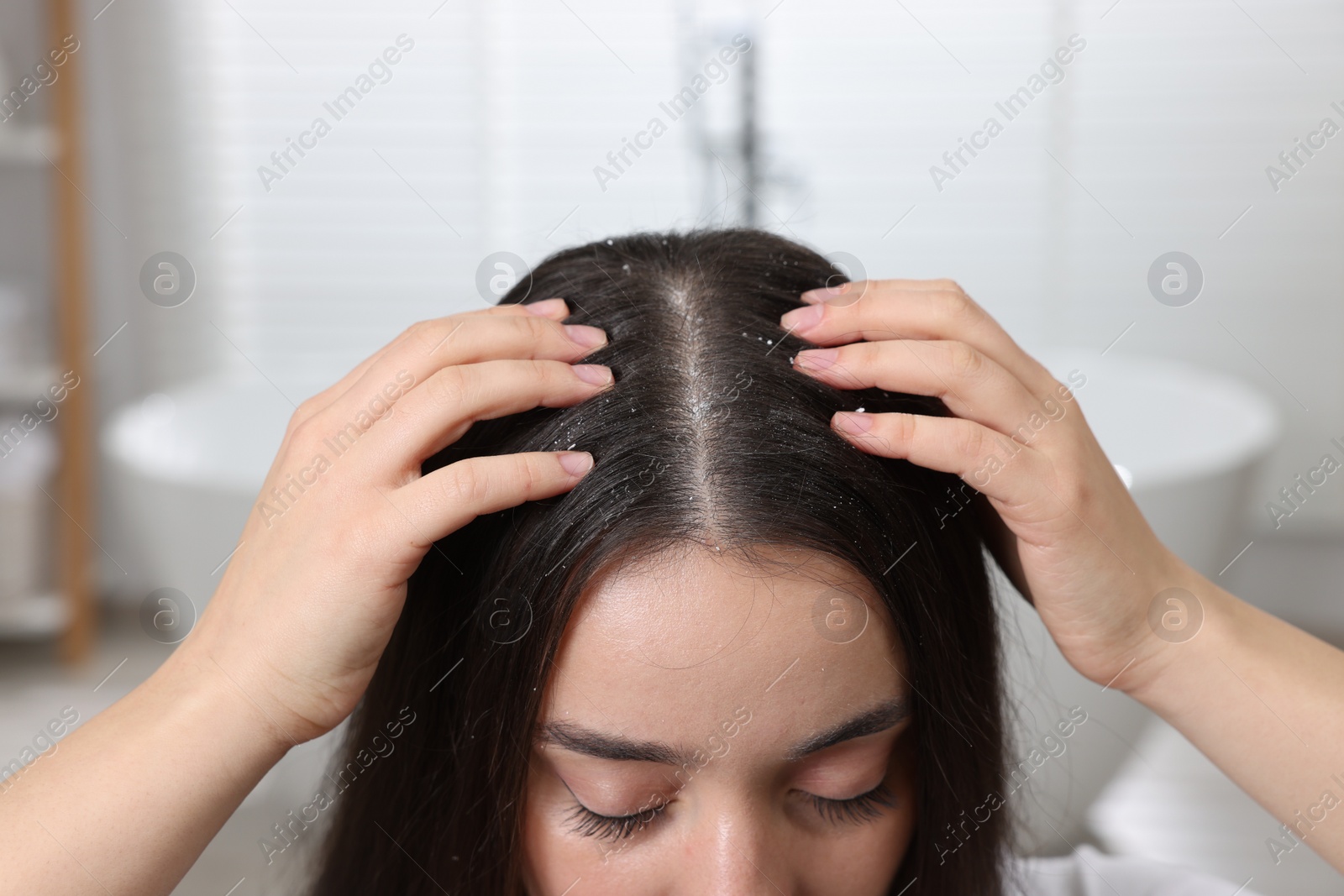 Photo of Woman examining her hair and scalp at home, closeup. Dandruff problem