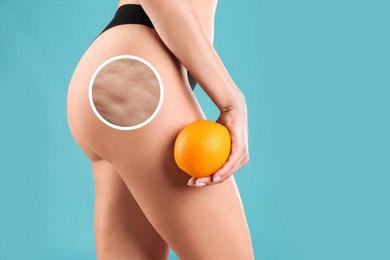 Image of Cellulite problem. Slim woman in underwear holding orange on light blue background, closeup. Zoomed skin with dimples