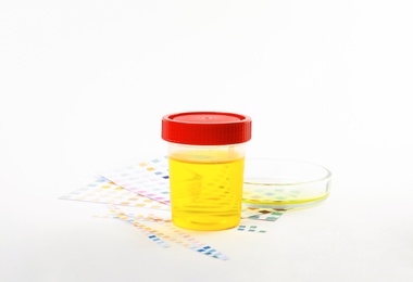 Photo of Laboratory ware with urine samples for analysis on white background