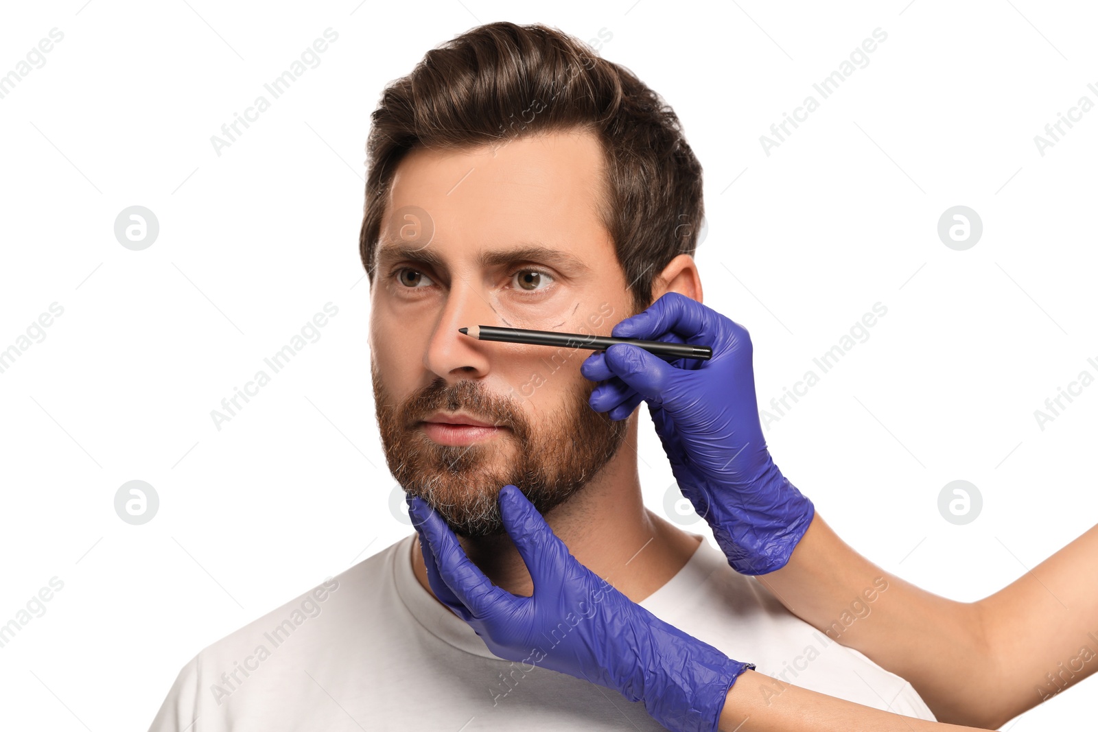 Photo of Doctor with pencil preparing patient for cosmetic surgery operation on white background