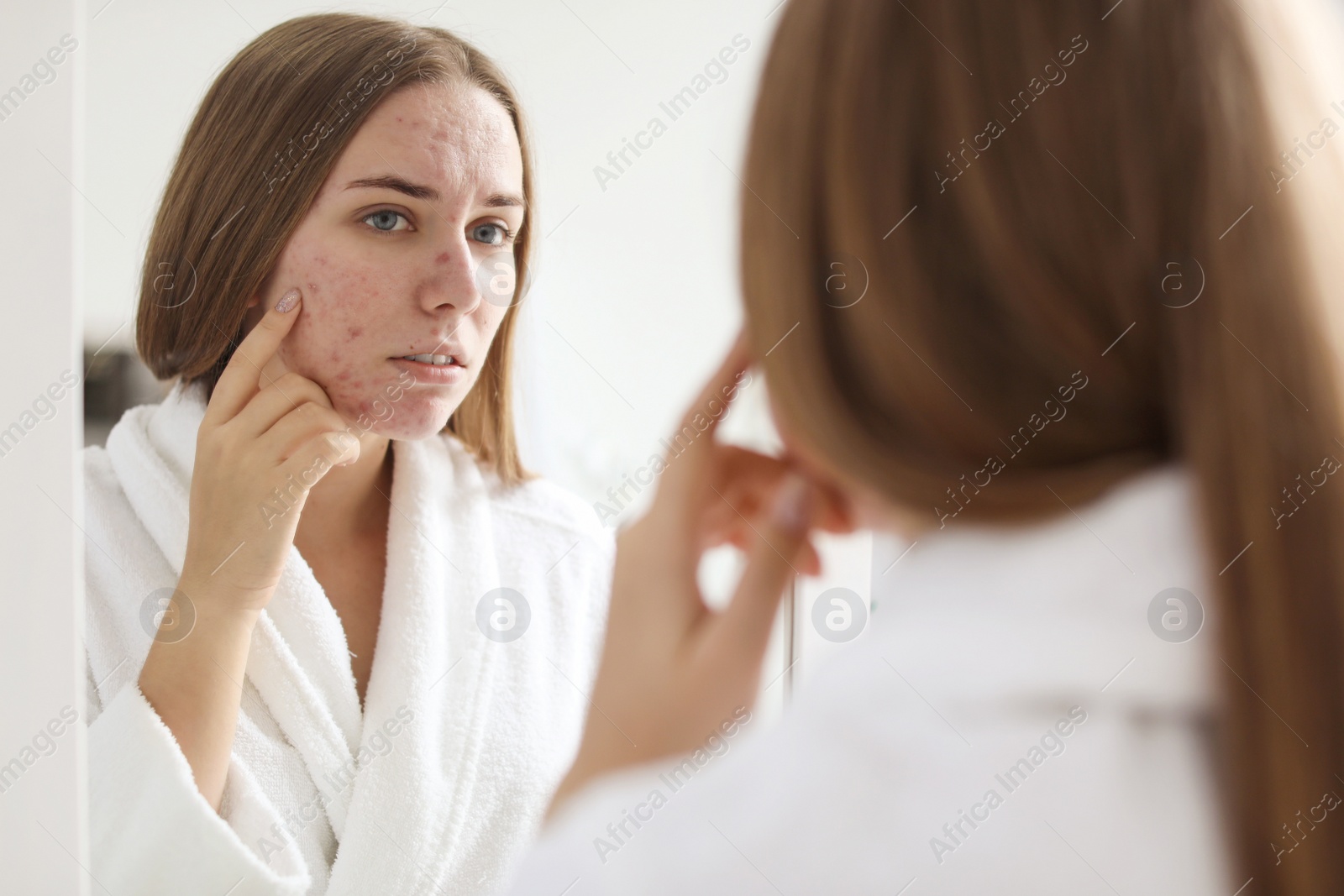 Photo of Young woman with acne problem near mirror in bathroom