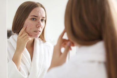 Photo of Young woman with acne problem near mirror in bathroom