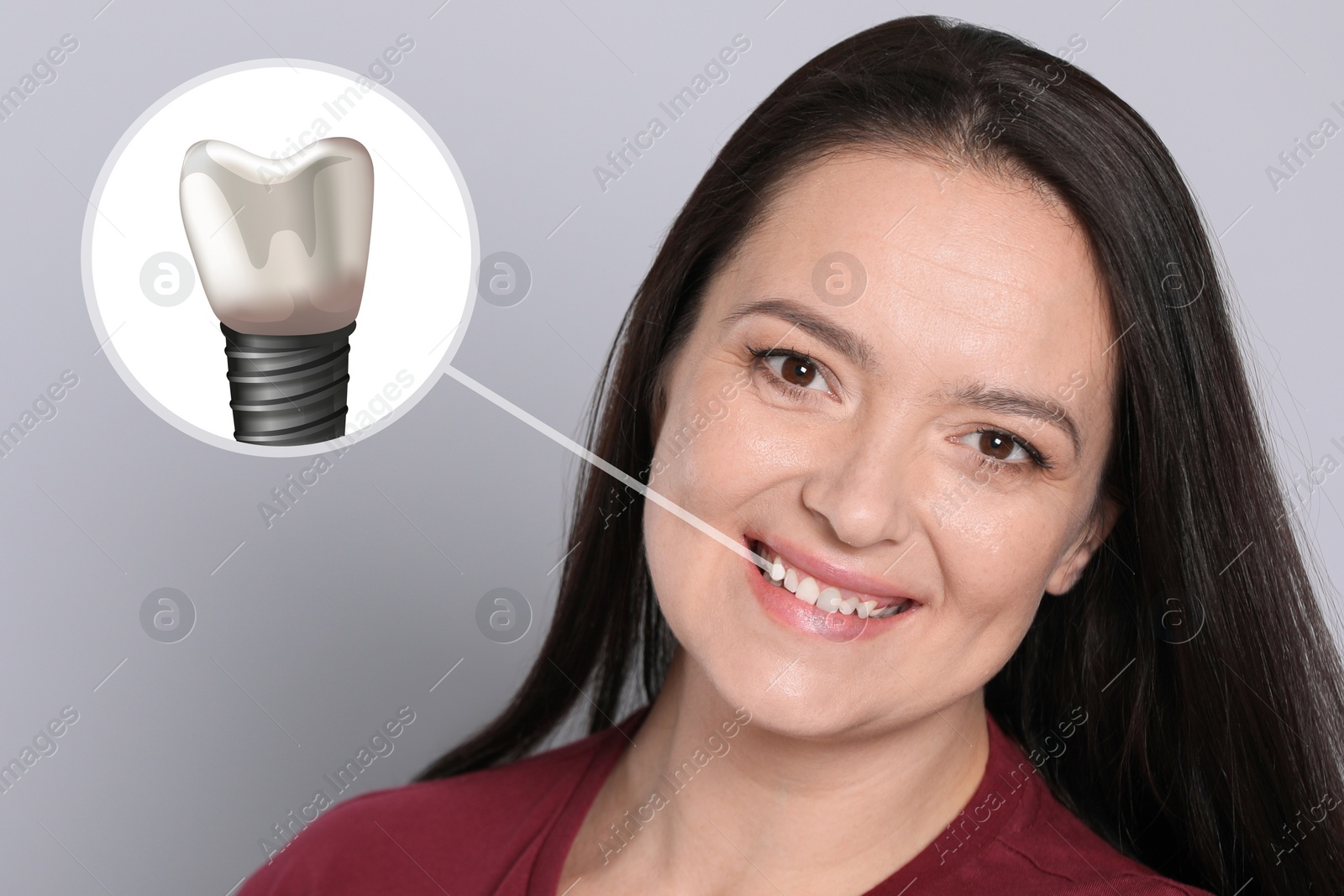 Image of Happy woman with perfect teeth smiling on light grey background. Illustration of dental implant