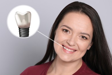 Image of Happy woman with perfect teeth smiling on light grey background. Illustration of dental implant