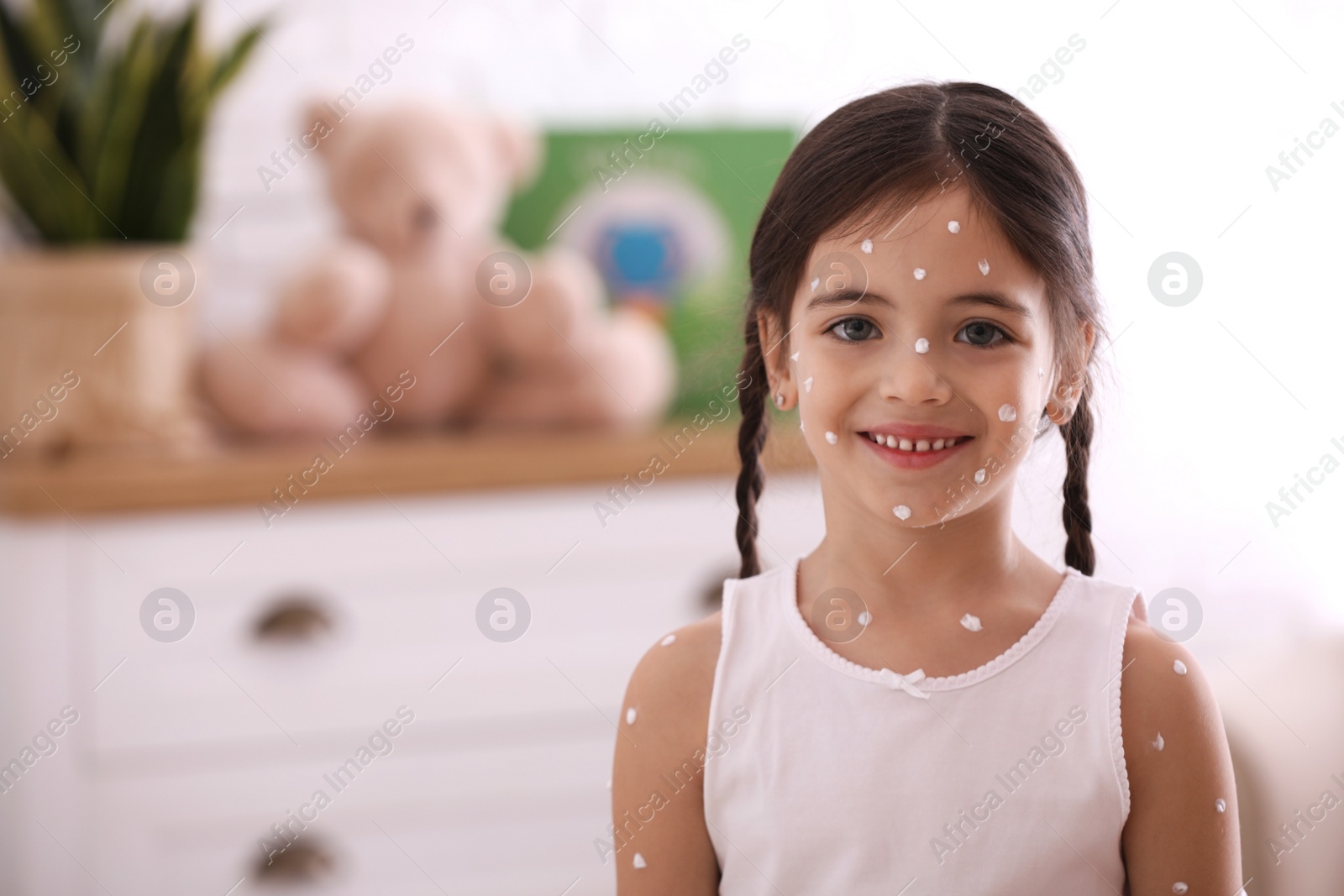 Photo of Adorable little girl with chickenpox at home. Space for text