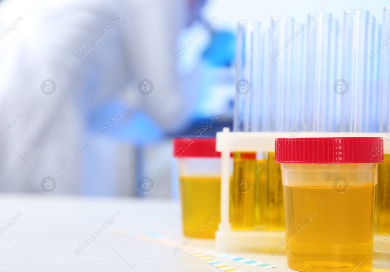 Photo of Containers with urine samples on table in laboratory, space for text. Medical analysis