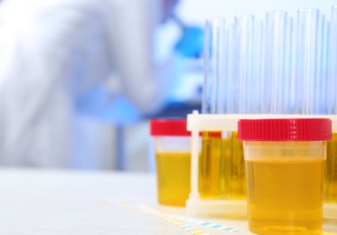 Photo of Containers with urine samples on table in laboratory, space for text. Medical analysis