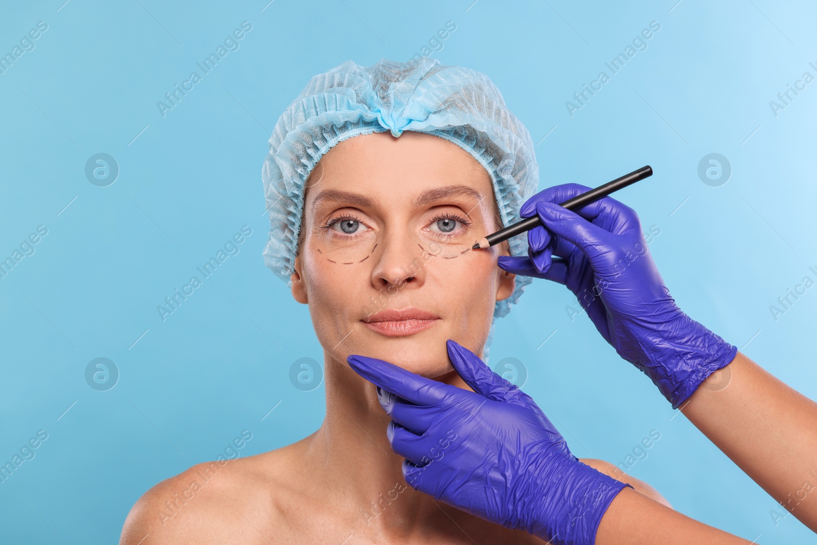 Photo of Doctor with pencil preparing patient for cosmetic surgery operation on light blue background