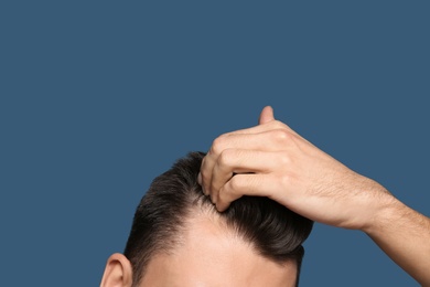 Photo of Young man with hair loss problem on color background