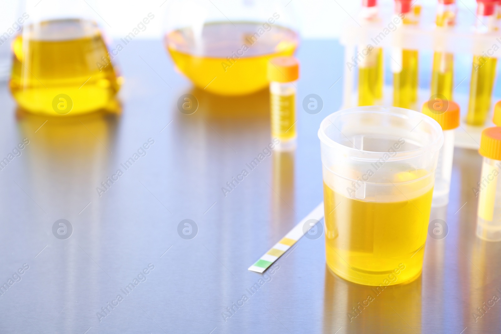 Photo of Laboratory ware with samples for urine analysis on table. Space for text