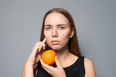 Photo of Young woman with acne problem holding orange on color background. Skin allergy