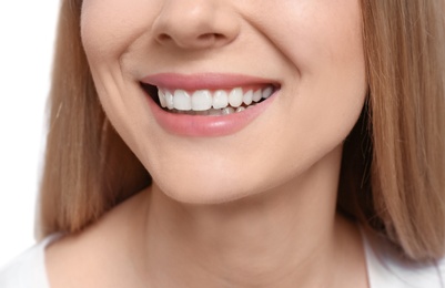 Young woman with beautiful smile, closeup. Teeth whitening