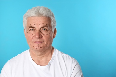 Mature man with marks on face for cosmetic surgery operation against blue background. Space for text