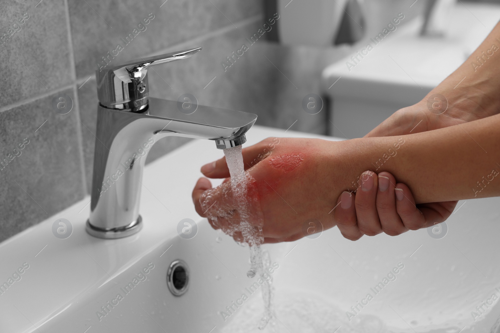 Photo of Woman holding burned hand under cold water indoors, closeup