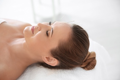 Photo of Young woman undergoing acupuncture treatment in salon