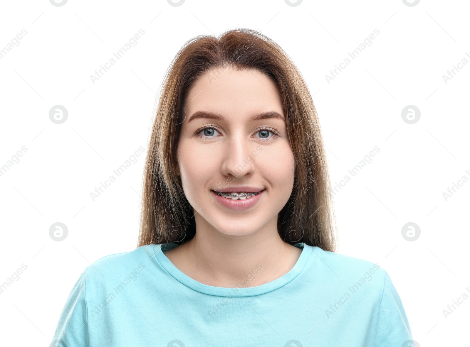 Photo of Portrait of smiling woman with dental braces on white background