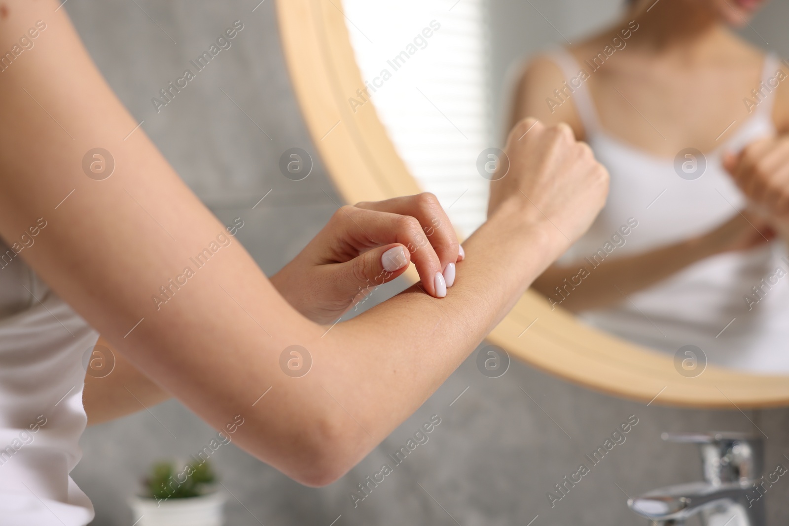 Photo of Woman with dry skin checking her arm indoors, closeup