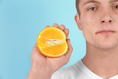 Young man with acne problem holding orange on color background. Skin allergy