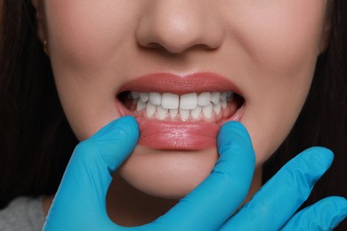 Doctor in glove examining woman's gums, closeup view