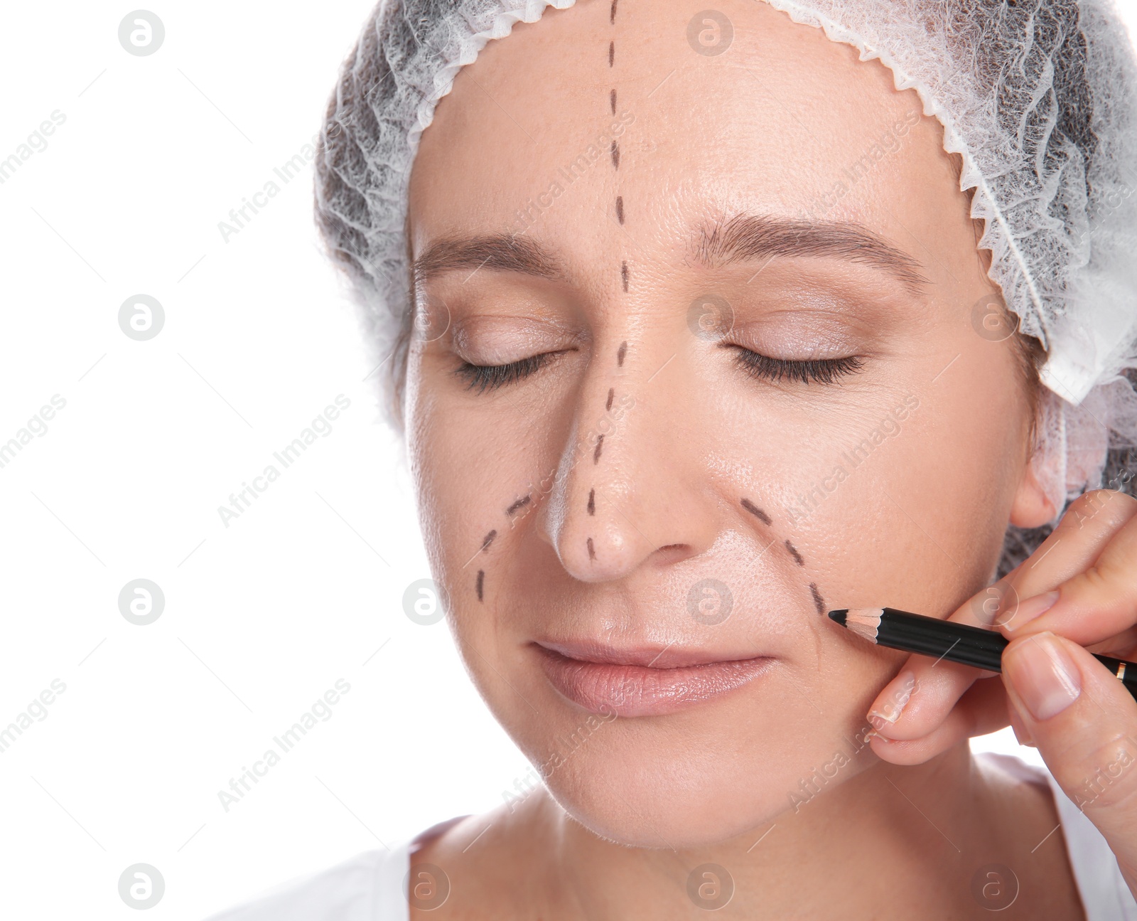 Photo of Doctor marking mature woman face before cosmetic surgery on white background