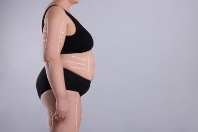 Image of Woman with marks on body before cosmetic surgery operation on light grey background, closeup. Space for text
