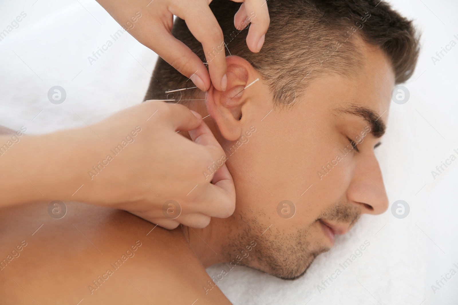 Photo of Young man undergoing acupuncture treatment in salon, closeup