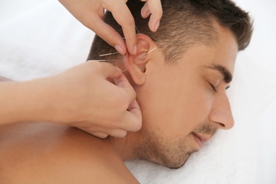 Young man undergoing acupuncture treatment in salon, closeup