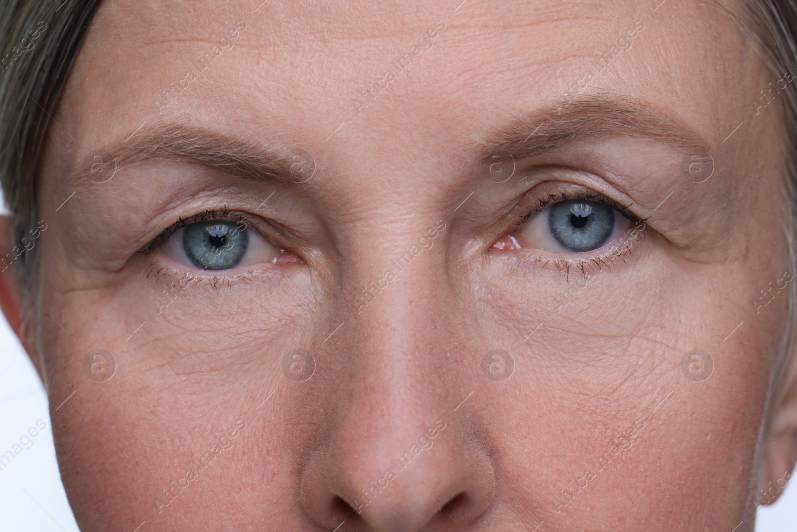 Photo of Senior woman with aging skin on white background, closeup. Rejuvenation treatment