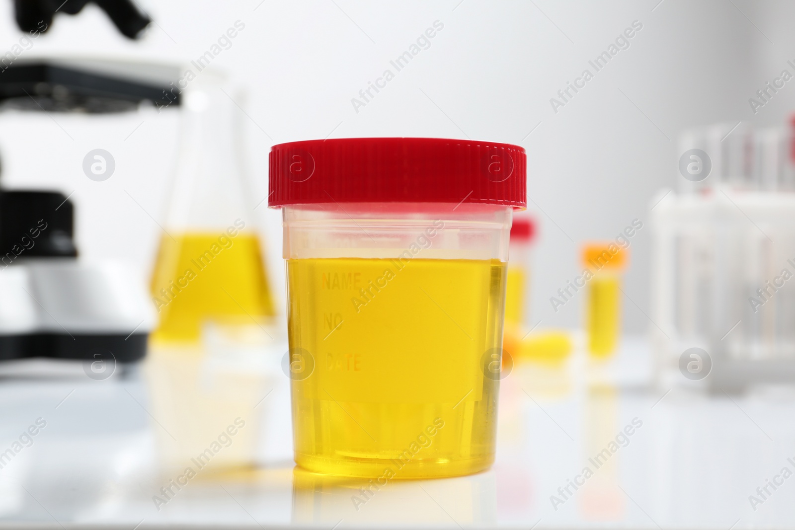 Photo of Container with urine sample for analysis on table in laboratory