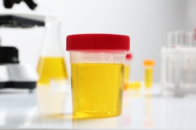 Photo of Container with urine sample for analysis on table in laboratory