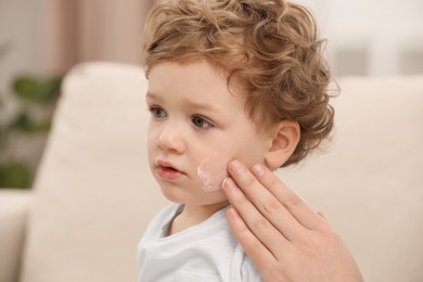 Photo of Father applying ointment onto his son`s cheek indoors