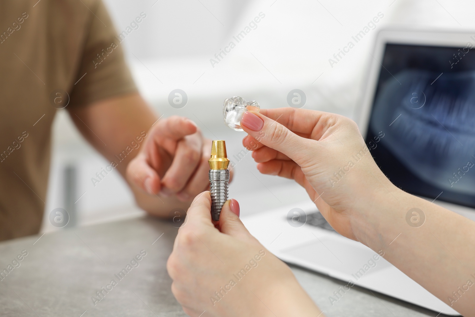 Photo of Doctor showing patient educational model of dental implant in clinic, closeup