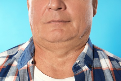 Photo of Mature man with double chin on blue background, closeup