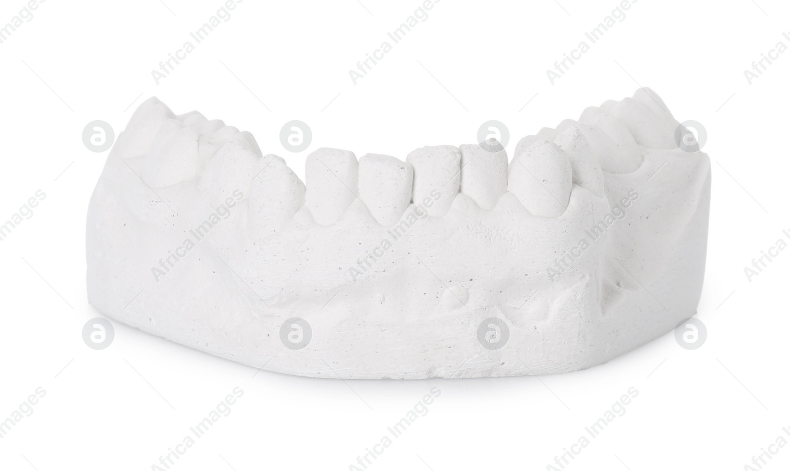 Photo of Dental model with gum isolated on white. Cast of teeth