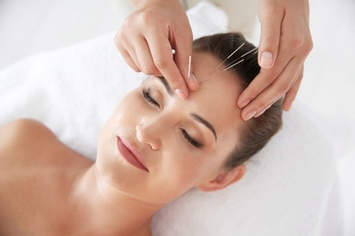 Young woman undergoing acupuncture treatment in salon