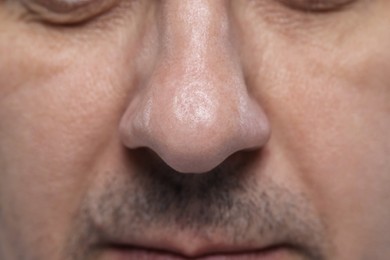 Photo of Closeup view of man with normal skin