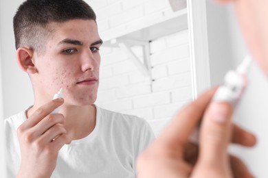Photo of Young man with acne problem applying cosmetic product onto his skin near mirror indoors