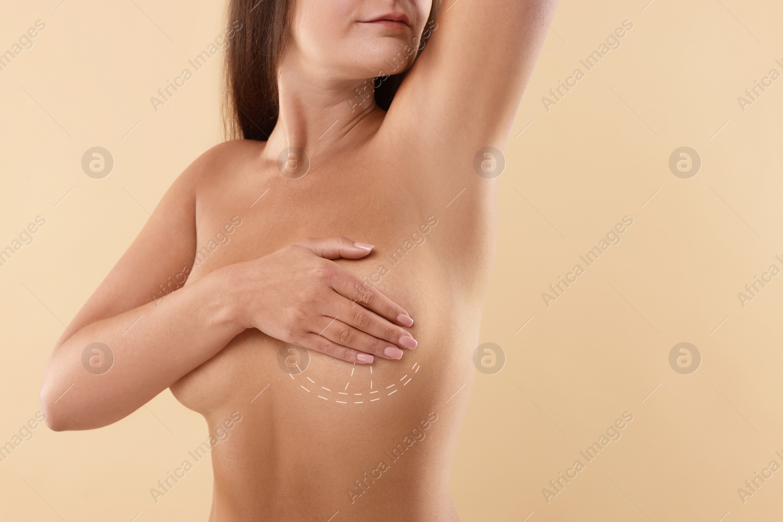 Image of Breast augmentation. Woman with markings for plastic surgery on skin against beige background, closeup. Space for text