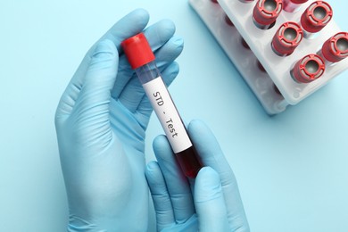 Photo of Scientist holding tube with blood sample and label STD Test on light blue background, top view