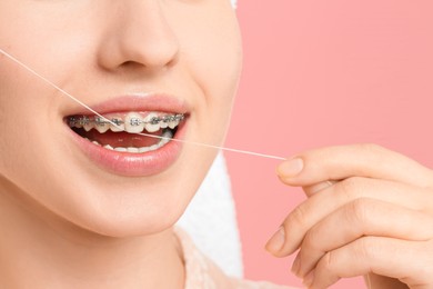 Woman with braces cleaning teeth using dental floss on pink background, closeup