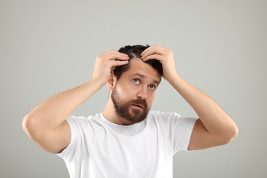 Man with dandruff in his dark hair on light gray background