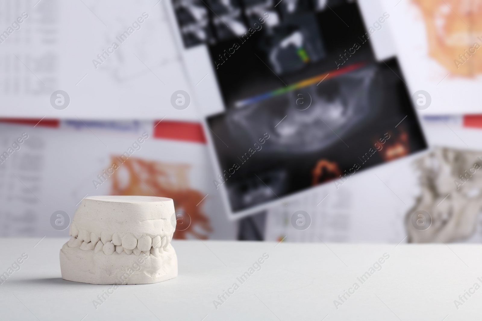 Photo of Dental model with gums on white table against panoramic x-ray, space for text. Cast of teeth