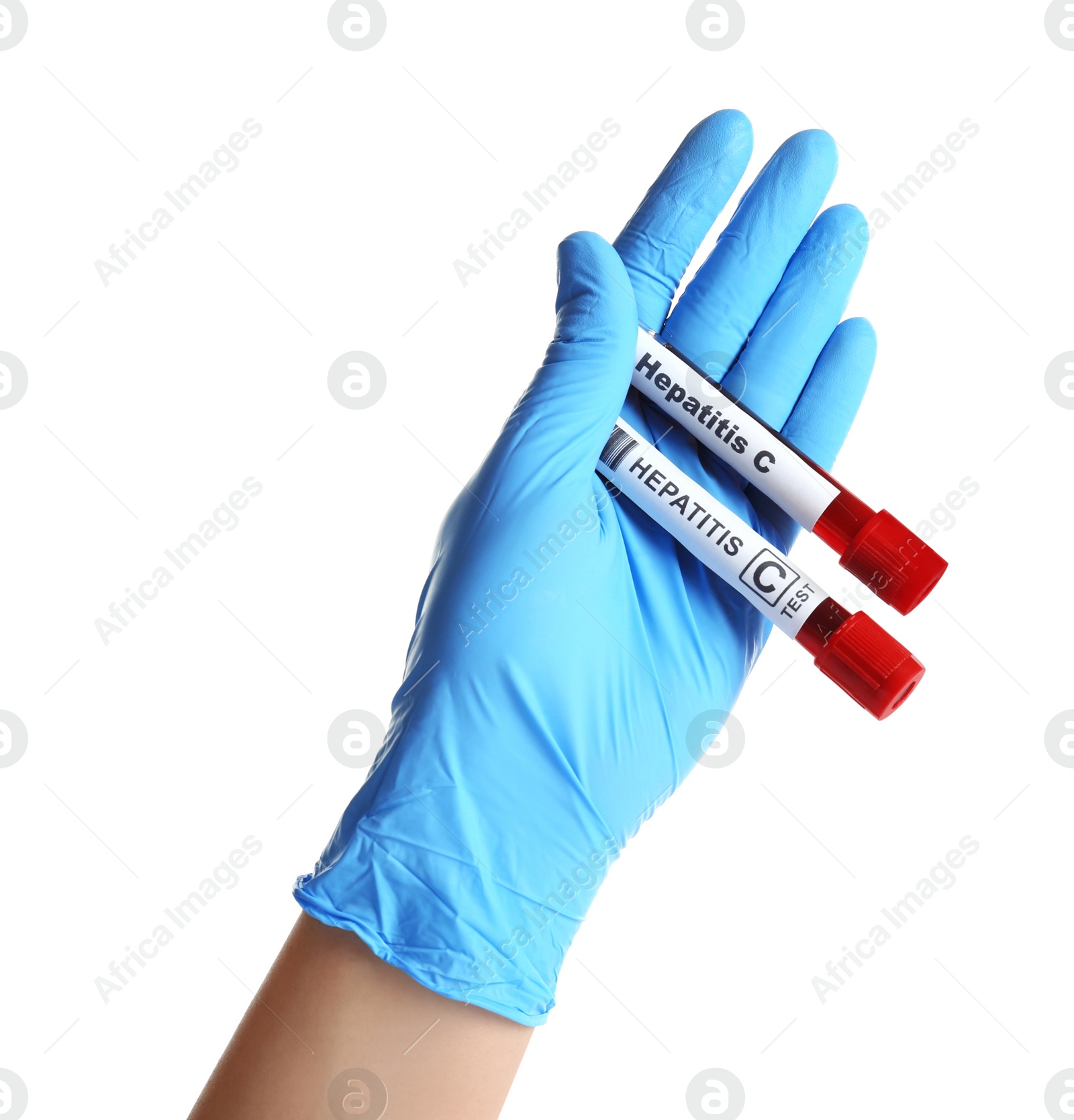 Photo of Scientist holding tubes with blood samples for hepatitis virus test on white background, closeup